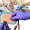 Phlebotomy & Injection Training Kit with Blood Simulation