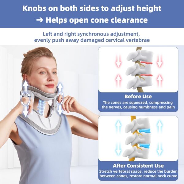 Cervical Traction Device SKY-NTD-2 (UP & DOWN Neck Traction Device)