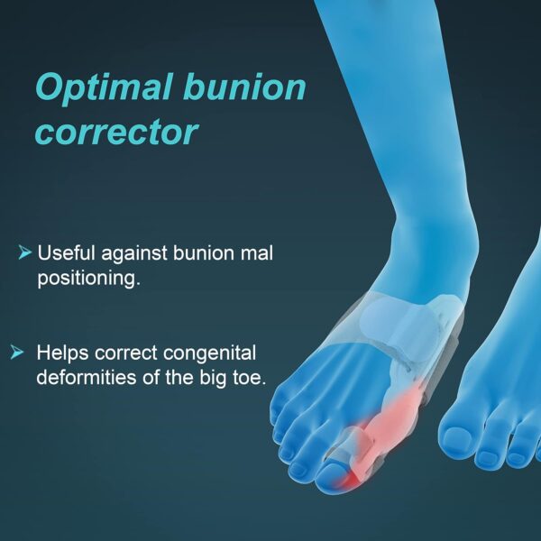 Bunion Corrector Toe Straightener Hallux Valgus Splint